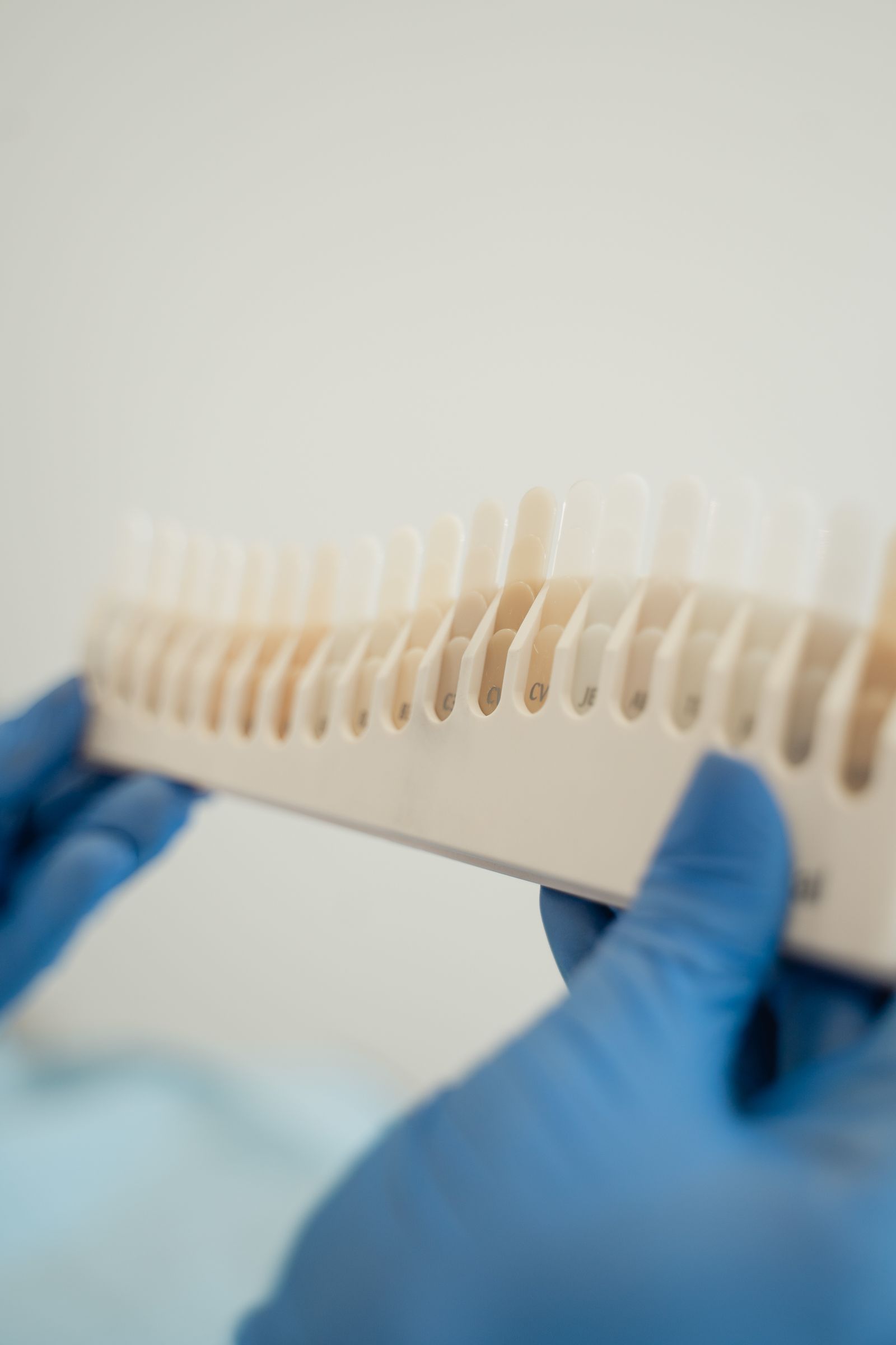 Blue-gloved hands holding a tooth shade guide with a row of enamel shade tabs.