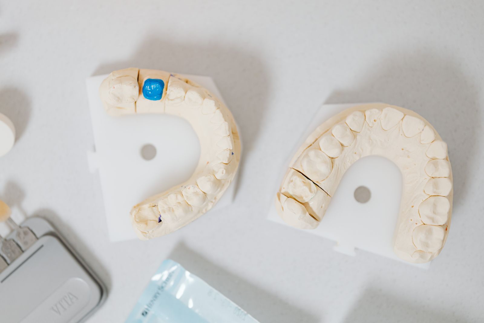 Two dental stone casts of upper and lower teeth on a bench, one carrying a shaped crown in place.