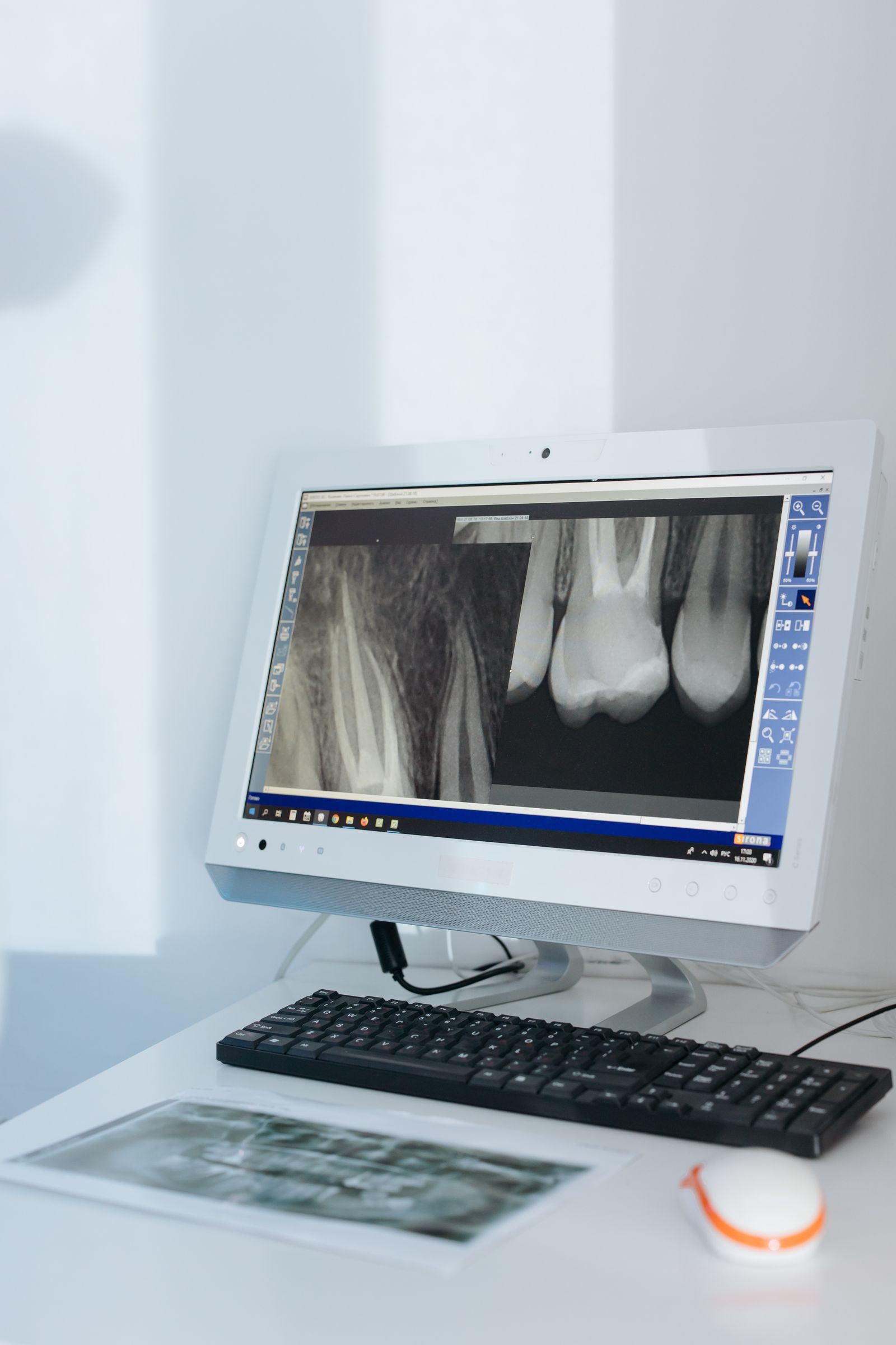 A chairside monitor displaying a digital dental X-ray on a clean white desk.