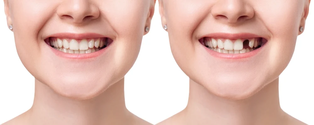 Choose Auburn Centre Dental for Your Dental Procedure